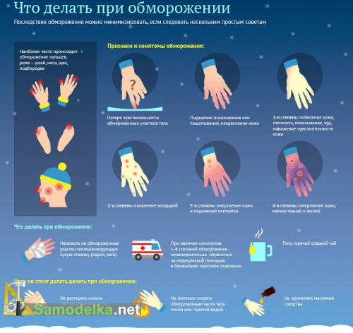 Что делать при обморожении - пара дельных советов